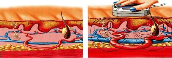 kui jalad lähevad tuimaks