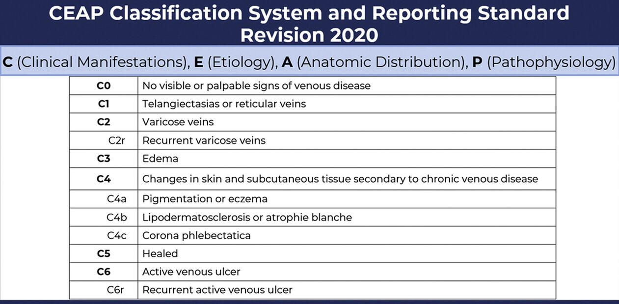 Veenilaiendite staadiumid vastavalt CEAP klassifikatsioonile koos muudatustega alates 2020. aastast